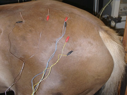 Electroacupuncture